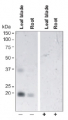 TIP2;2 | tonoplast intrinistic protein 2-2, C-terminal